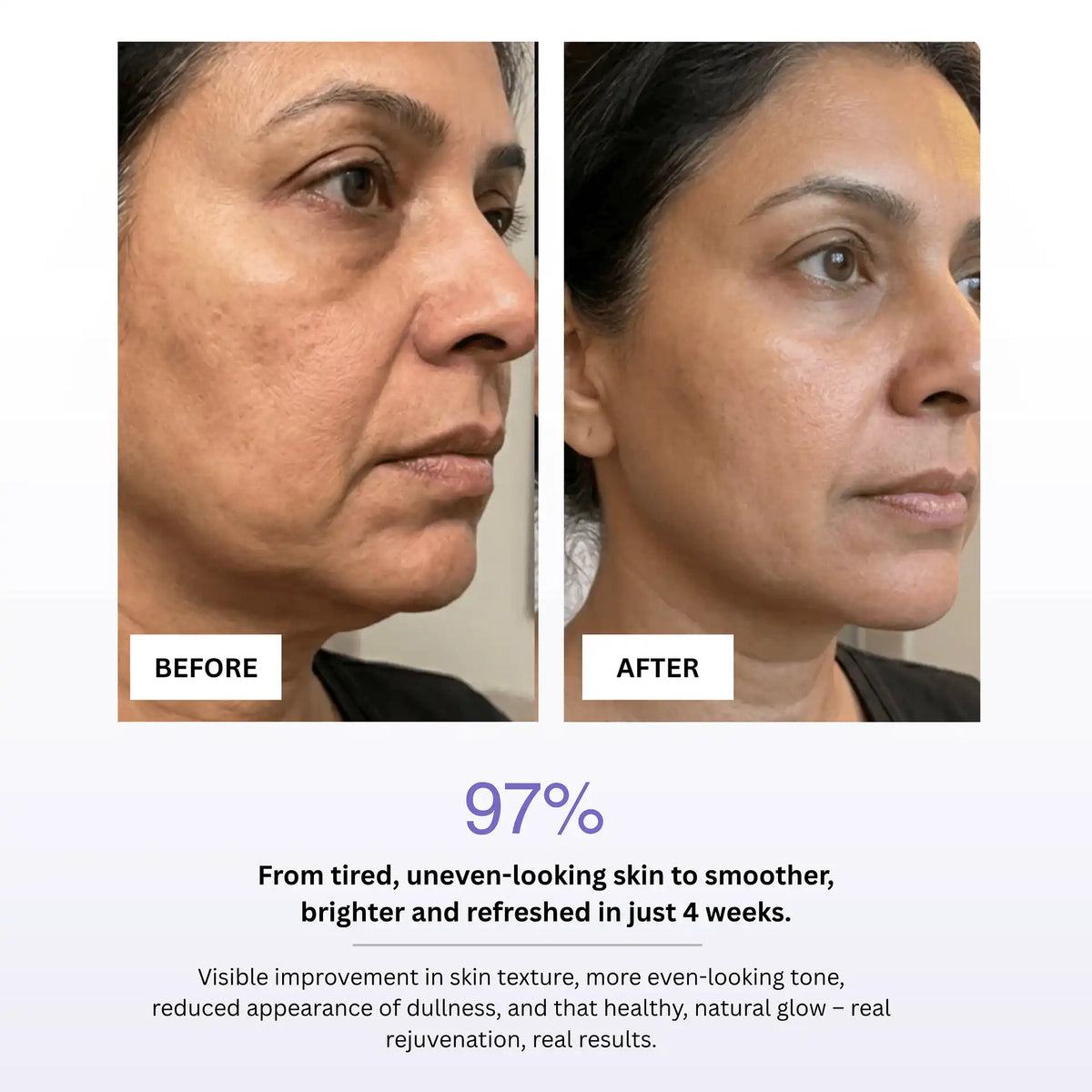 7 In 1 LED Facial Sculptor