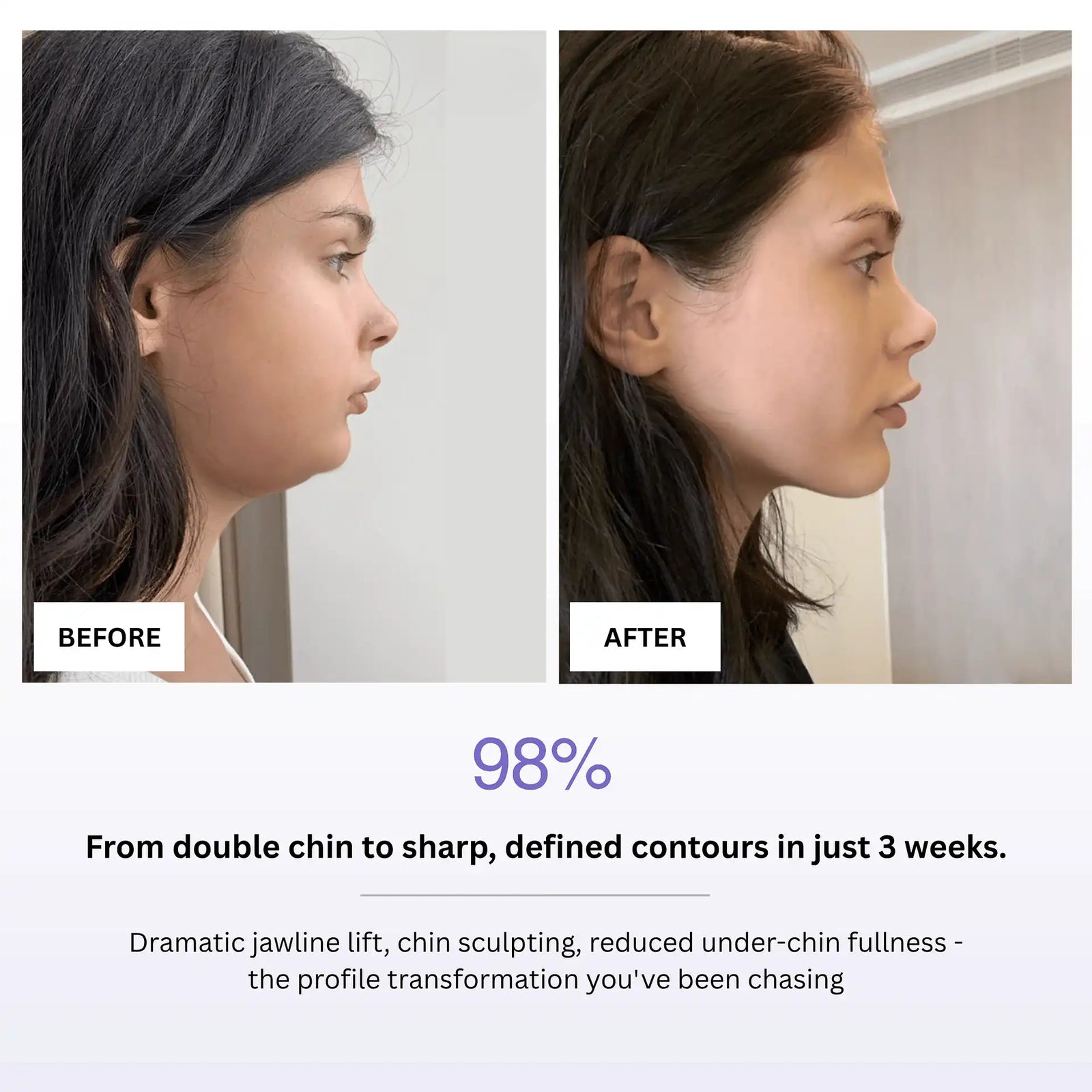 7 In 1 LED Facial Sculptor
