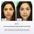Before and after comparison of a woman's face with text indicating improvement in eye area.