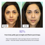 Before and after comparison of a woman's face with text indicating improvement in eye area.