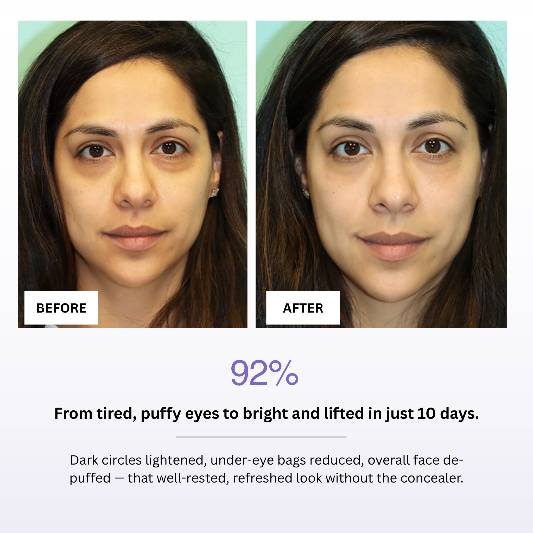 Before and after comparison of a woman's face with text indicating improvement in eye area.