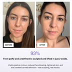 Before and after comparison of a woman's face with text indicating results from a skincare or facial treatment.