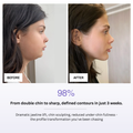 Before and after comparison of a woman's profile with text highlighting jawline lift and chin sculpting results.