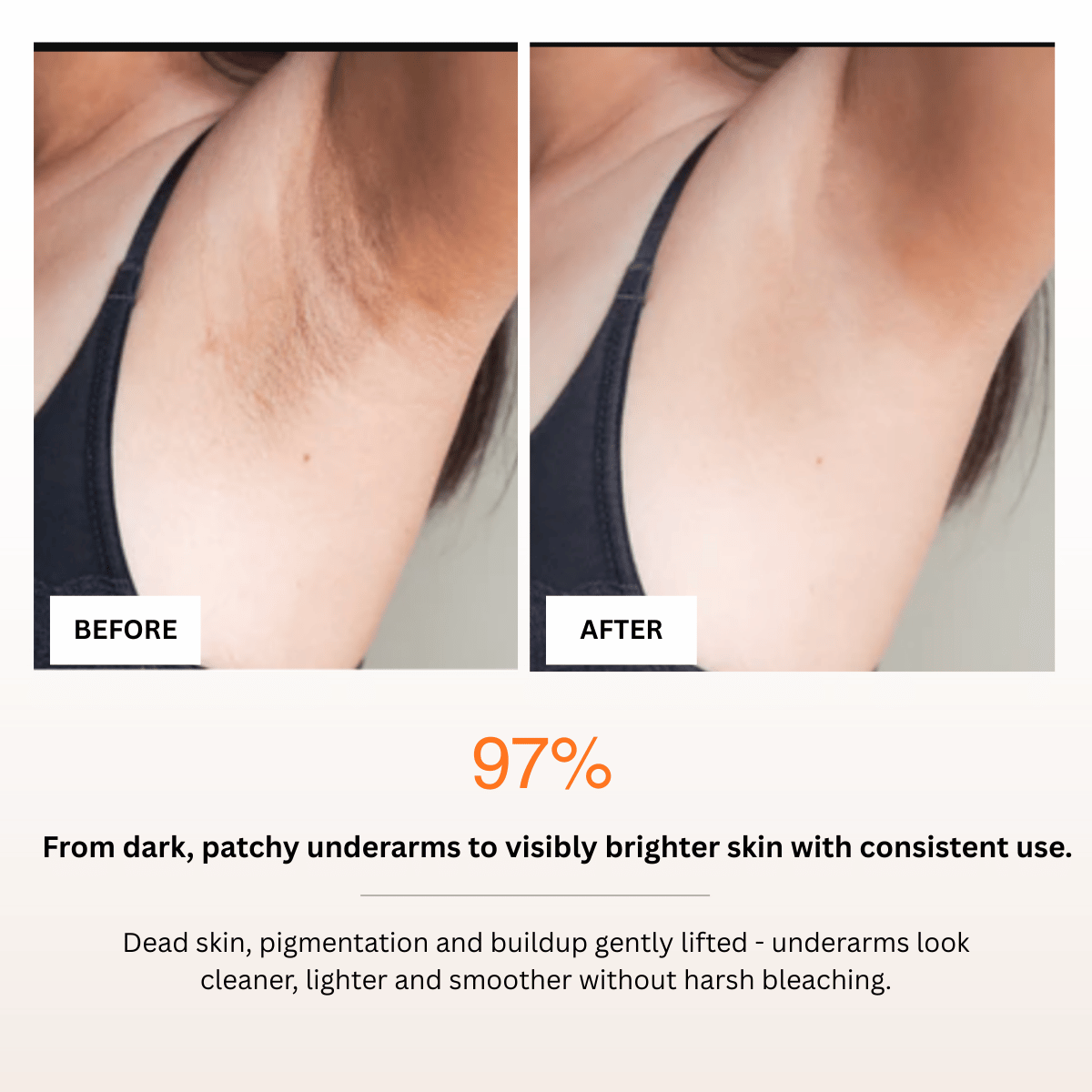 Before and after comparison of underarm skin with a product claim on a white background