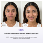 Before and after comparison of a woman's face with text indicating product effectiveness.