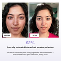Before and after comparison of skin treatment with text indicating improvement.