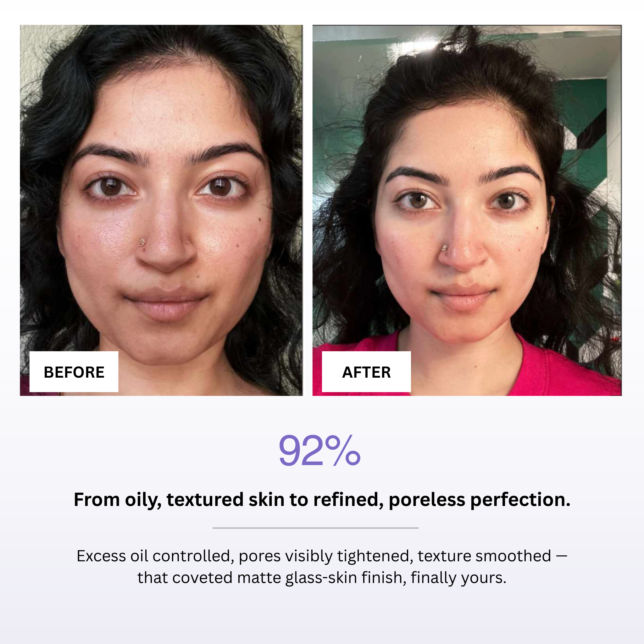 Before and after comparison of skin treatment with text indicating improvement.