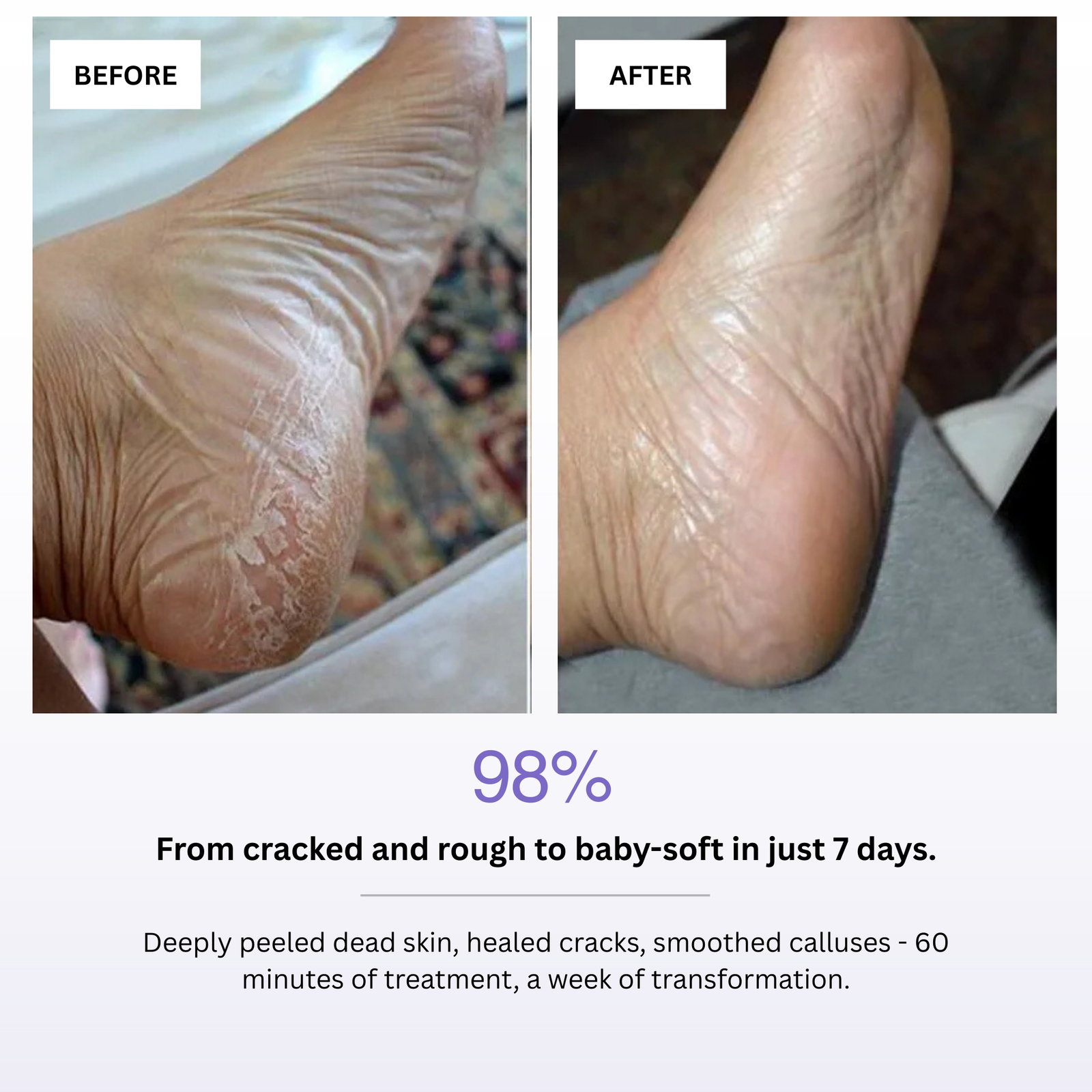 Before and after comparison of cracked and rough skin on a foot, showing improved skin condition with text indicating transformation in 7 days.