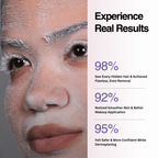 Advertisement showing a close-up of a person's face with text highlighting dermaplaning results.