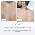 Before and after comparison of a person's back with visible acne, showing clearer skin.