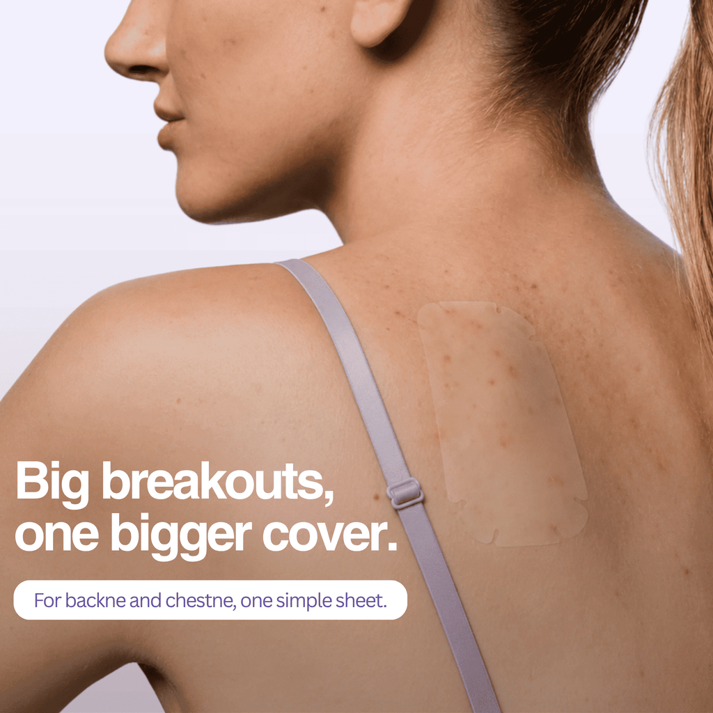 Woman wearing a back patch with text about covering large acne patches.