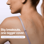Woman wearing a back patch with text about covering large acne patches.