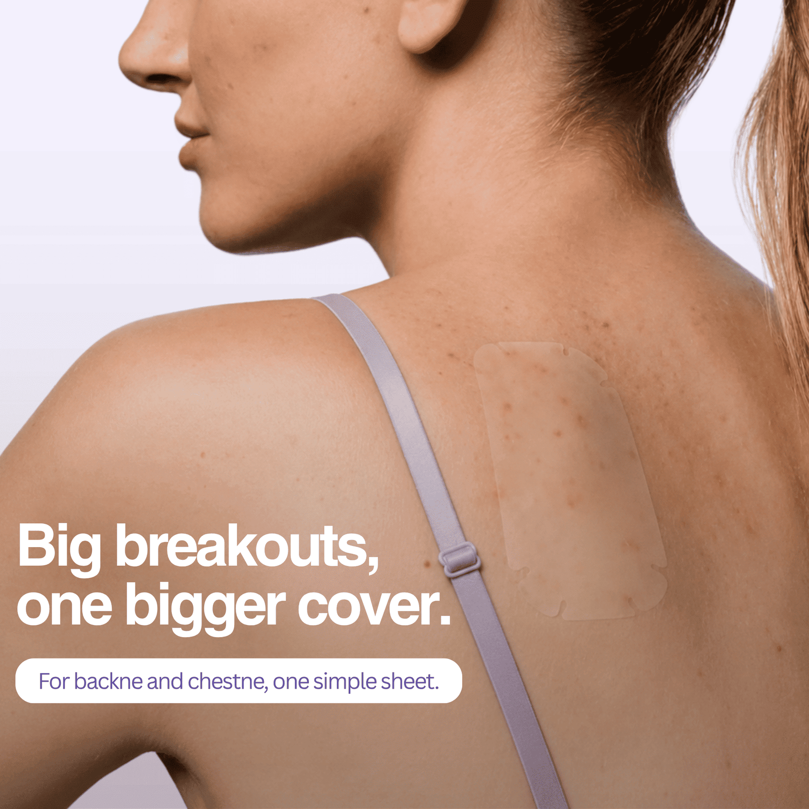 Woman wearing a back patch with text about covering large acne patches.