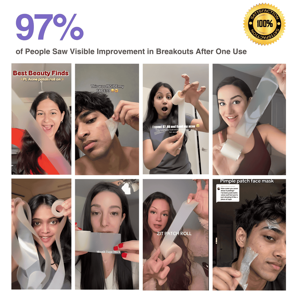 Collage of people using a pimple patch face mask with text indicating visible improvement after one use.