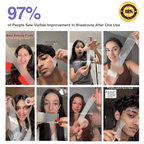 Collage of people using a pimple patch face mask with text indicating visible improvement after one use.