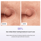 Before and after comparison of skin with a spot, showing 98% reduction in breakouts.