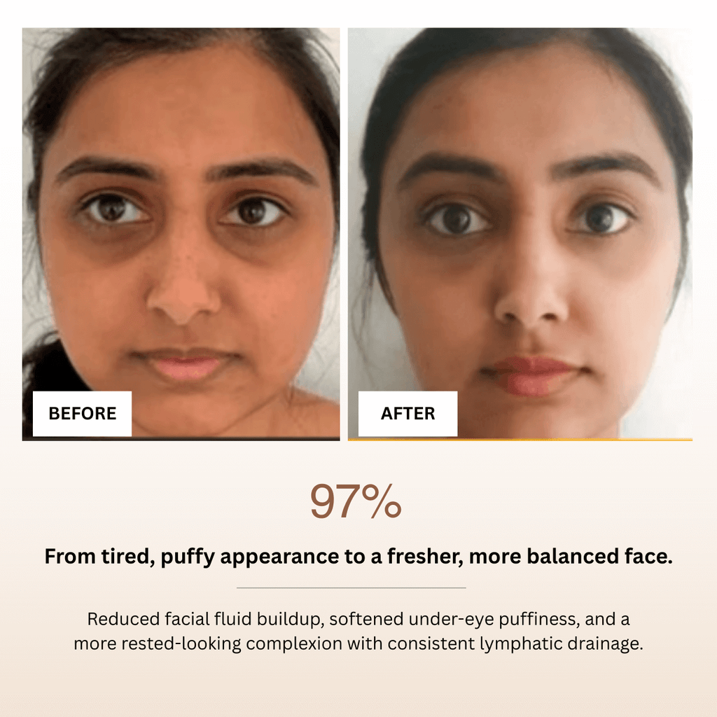 Before and after comparison of a person's face with text indicating improvement in appearance.