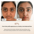 Before and after comparison of a person's face with text indicating improvement in appearance.