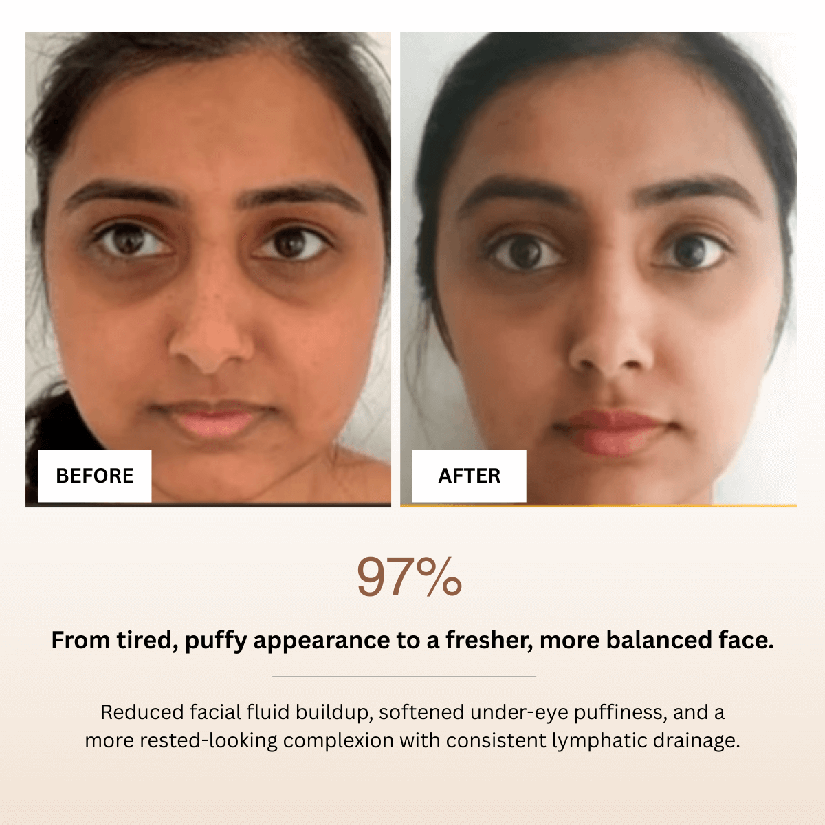 Before and after comparison of a person's face with text indicating improvement in appearance.