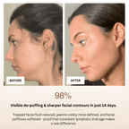 Before and after comparison of a woman's face with text highlighting visible de-puffing and sharper facial contours.