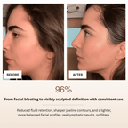 Before and after comparison of a woman's face with text indicating results from consistent use.