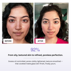 Before and after comparison of skin treatment with text indicating improvement.