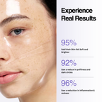 Woman's face with skincare product application and statistics on skin benefits.